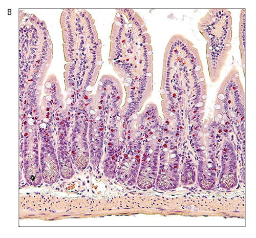Fig B: These cells can secrete prodigious amounts of IL-9, which fueled intestinal allergy reactions shown here in mice.